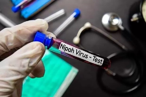 Bo Y te Indonesia keu goi canh giac cao do doi voi virus Nipah hinh anh 1