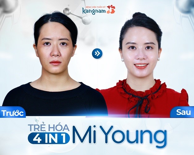 Trẻ hóa da Kangnam: Một vé về thanh xuân với làn da mịn màng, trẻ trung