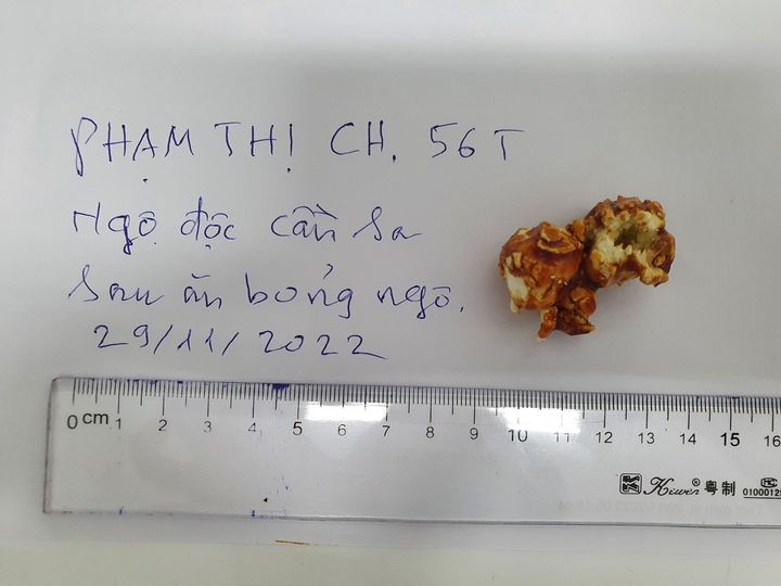 mot phu nu nhap vien vi an bong ngo nghi bi tam can sa hinh 1