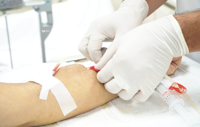 Điều dưỡng khoa Nội thận - Lọc máu, Bệnh viện Đa khoa Tâm Anh TP HCM chuẩn bị đường dẫn máu cho người chạy thận. Ảnh: Bệnh viện cung cấp