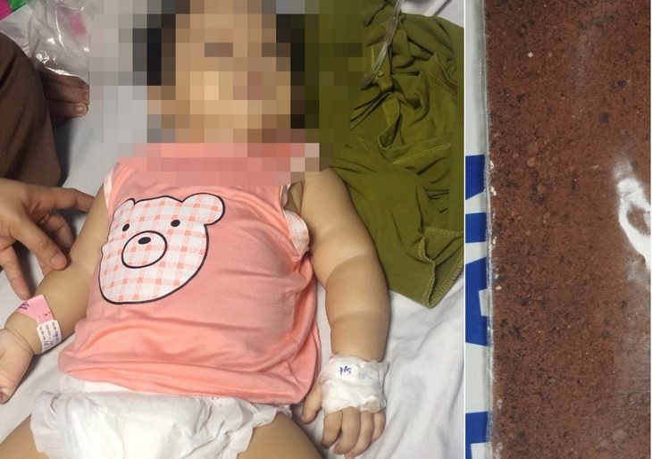 Cháu bé 11 tháng tuổi bị ngộ độc chì nặng sau khi gia đình cho dùng thuốc gia truyền - Ảnh: N.HÂN