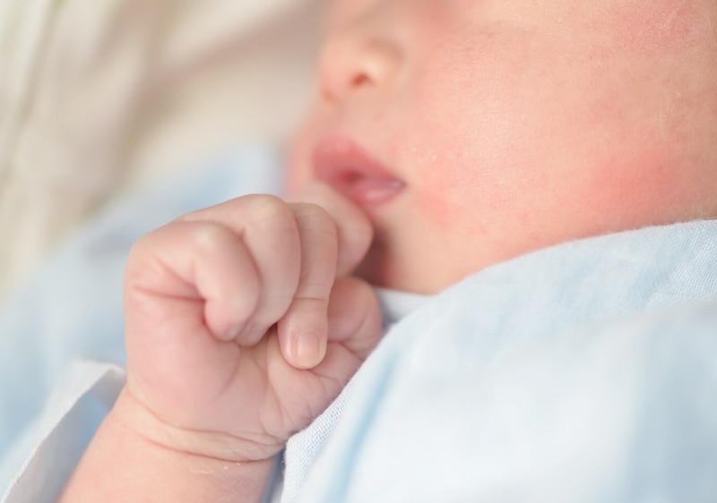 Trẻ sơ sinh phát ban nhiệt còn gọi là nổi rôm sảy - tình trạng khá phổ biến