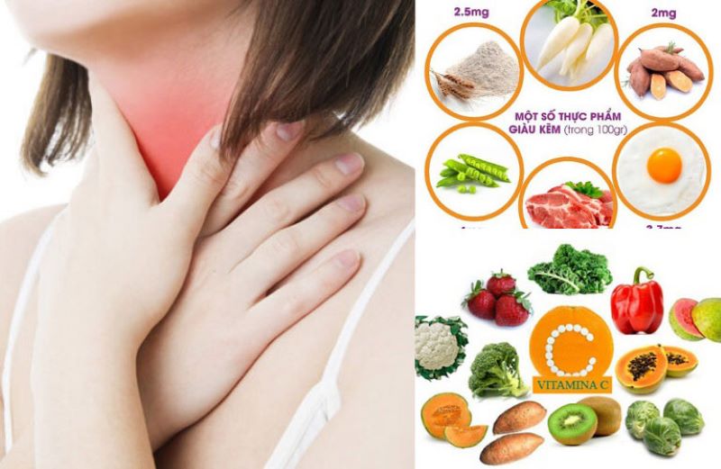 Tăng cường bổ sung thực phẩm giàu vitamin và khoáng chất khi bị đau họng