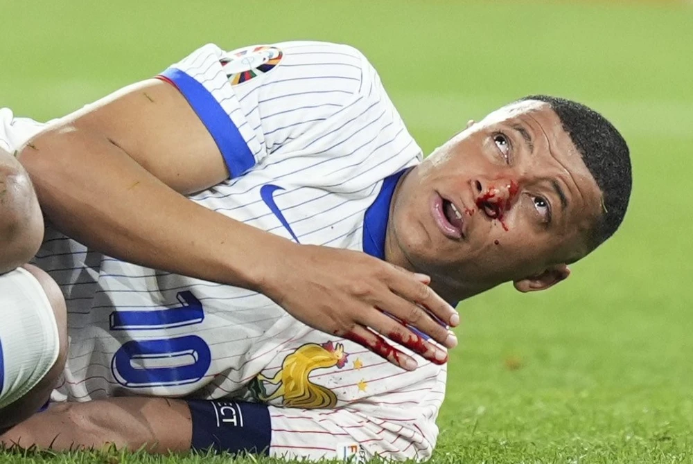 Mbappe dính chấn thương mũi trong trận Pháp thắng Áo 1-0. (Nguồn: X)