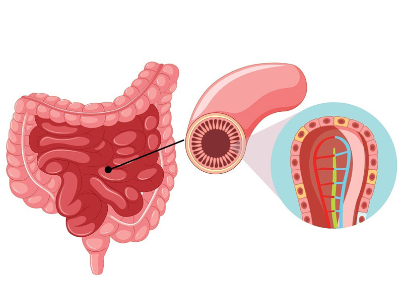 Viêm ruột do ký sinh trùng - bệnh lý liên quan đến nhiễm trùng đường ruột