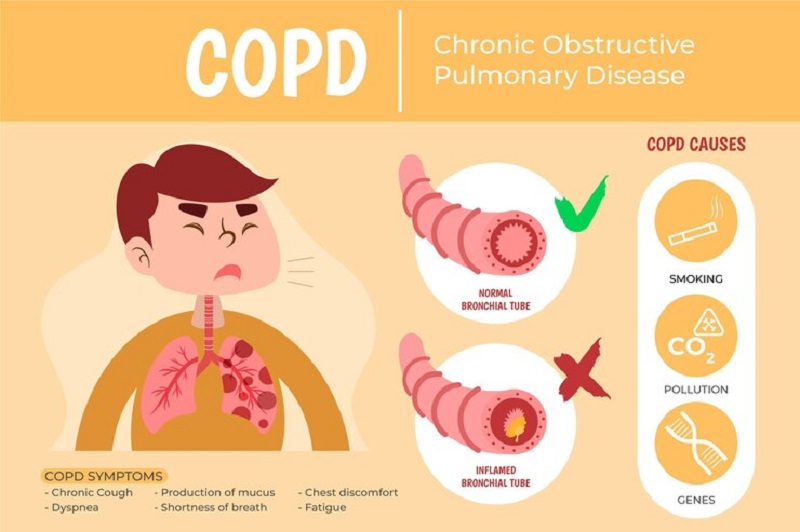 Causes And Diagnosis - Vietnam.vn